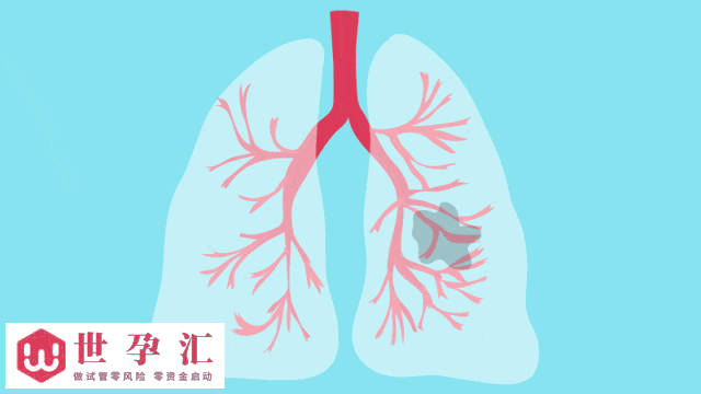 慢阻肺防治卡点仍不少