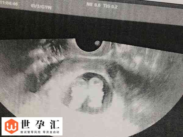 试管孩子是不是真的智商低(图4)