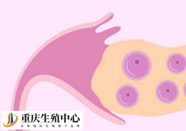 试管促排期间可注射达必佳