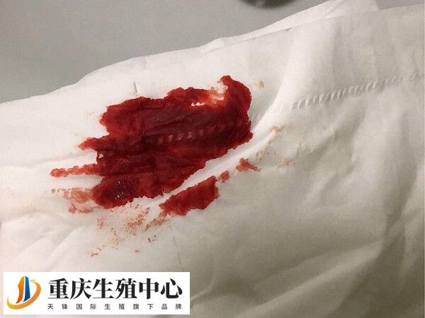 移植十四天出血腹痛不排除是流产的先兆