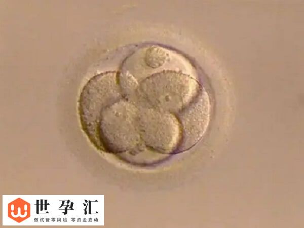试管精卵结合却不发育怎么办(图2)