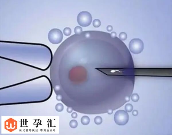 试管进周前血压高怎么办(图2)