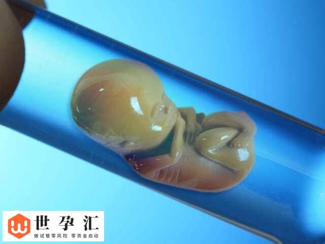 前列腺炎对试管婴儿的影响有哪些(图1)